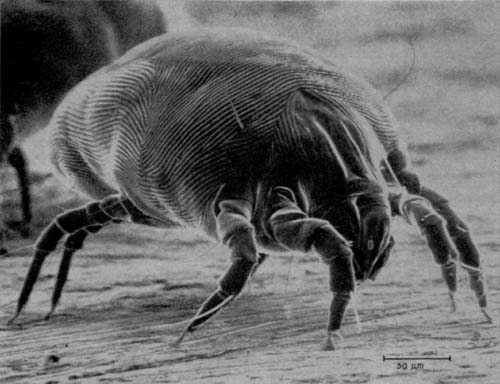 How To Get Rid Of Dust Mites: 10 Things You need to Know