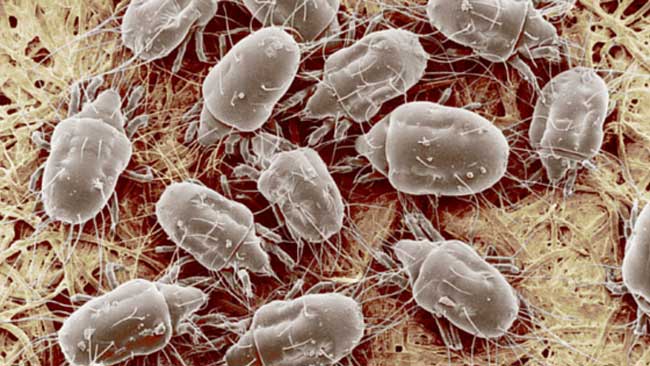 How To Get Rid Of Dust Mites: 10 Things You need to Know